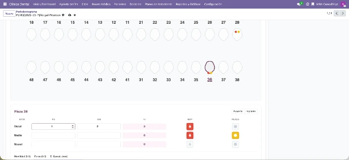 Registro detallado de profundidad de bolsas, sangrado y movilidad gingival.
