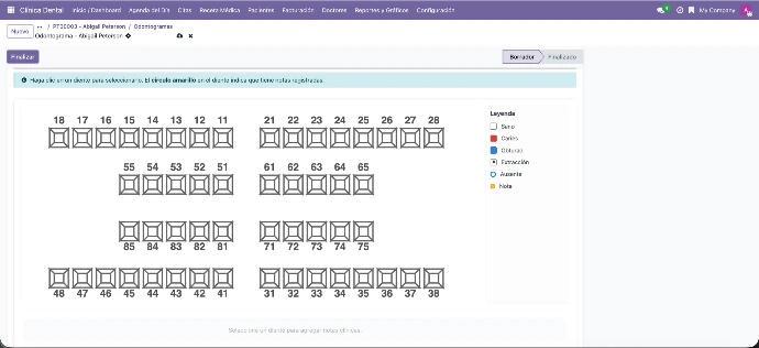 Dibujo digital sobre las piezas dentales para marcar hallazgos y tratamientos.